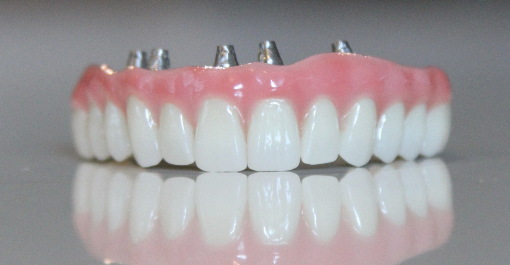 Full-arch implant restoration