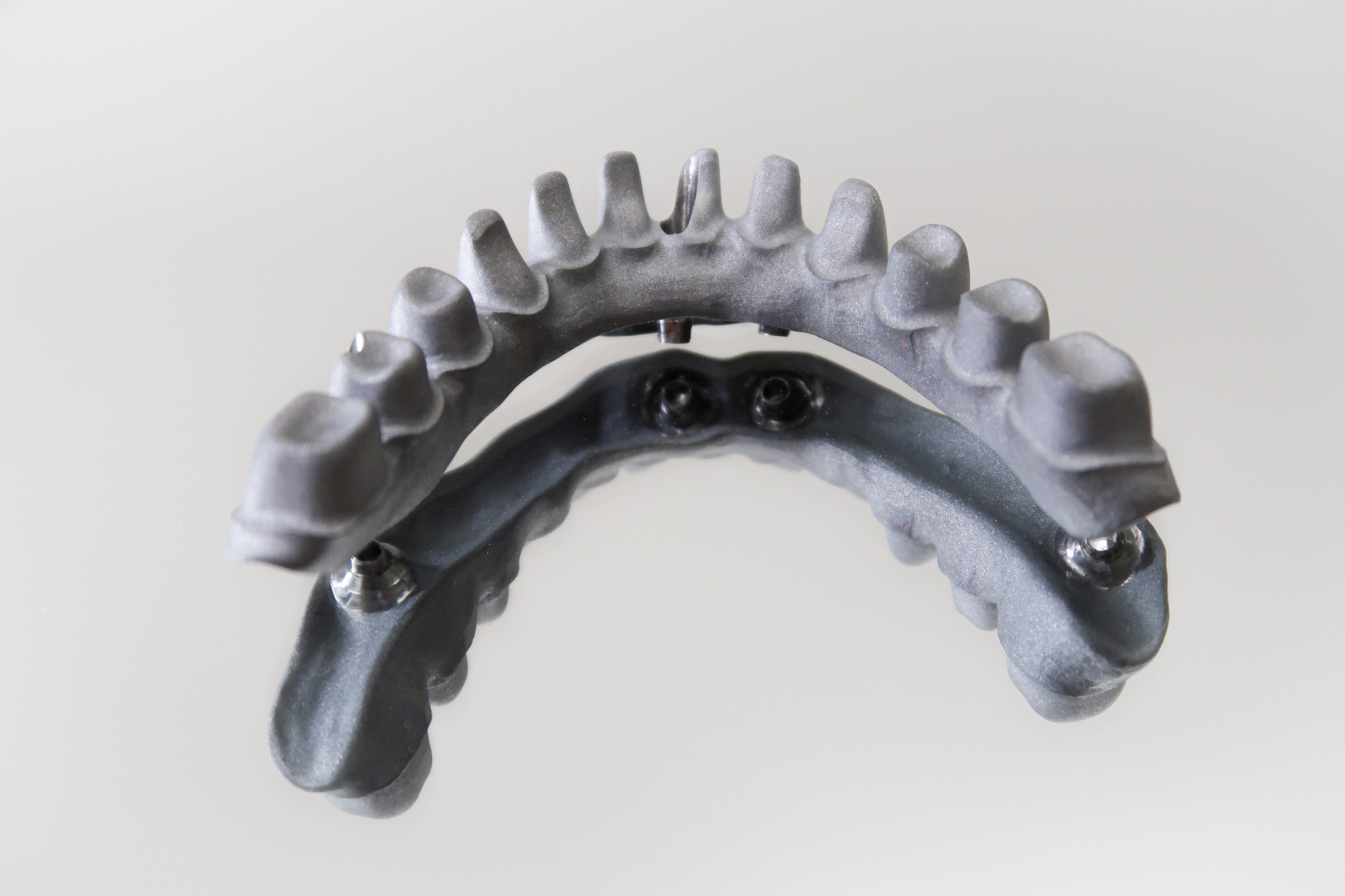 Full-arch framework, top view